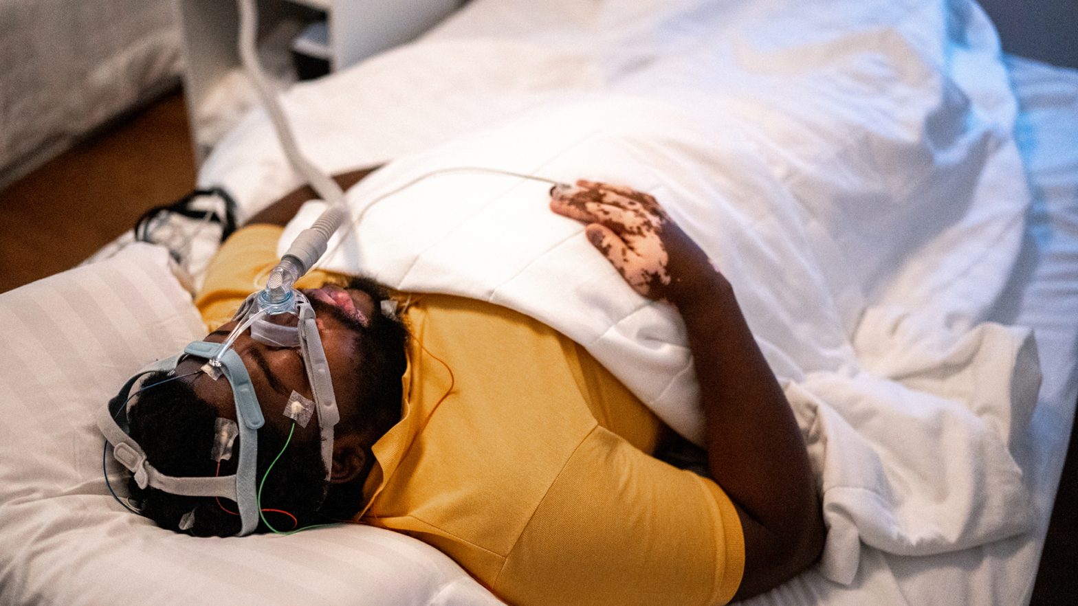 Black Men Are Dying At Increasing Rates From Sleep Apnea Compared To Their White Counterparts, Study Finds